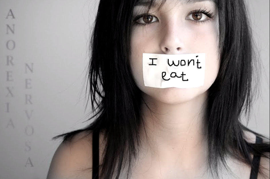 anoressia disturbi del comportamento alimentare